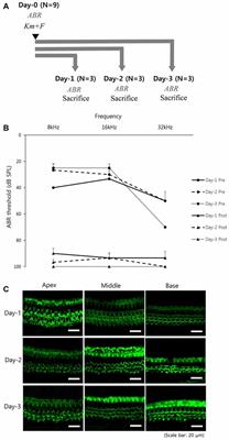 Novel Peptide Vaccine GV1001 Rescues Hearing in Kanamycin/Furosemide-Treated Mice